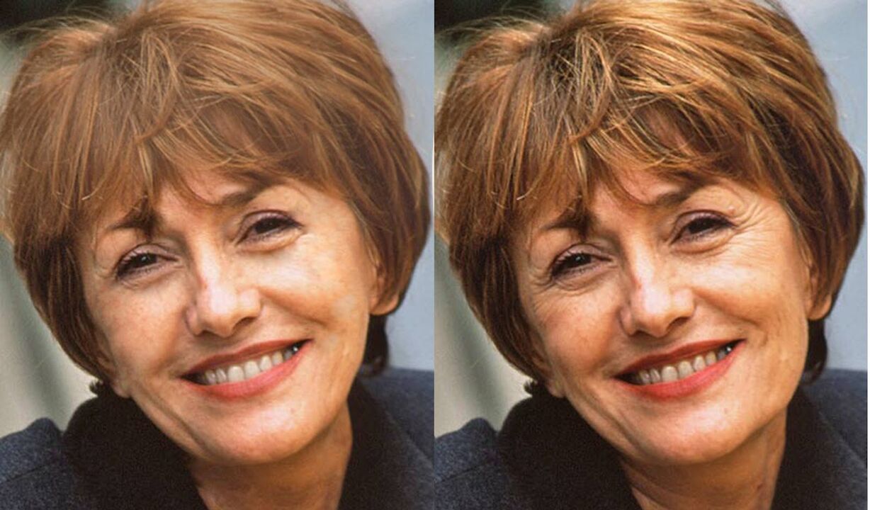 Photos de visage avant et après le contouring